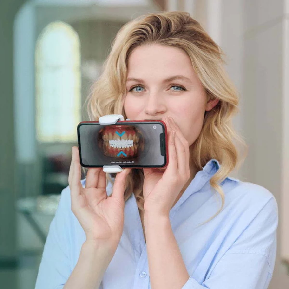 Dental Monitoring ScanBox and smartphone app